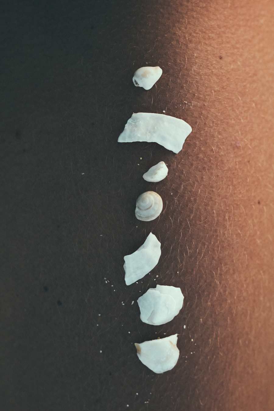 Photo pain assessment